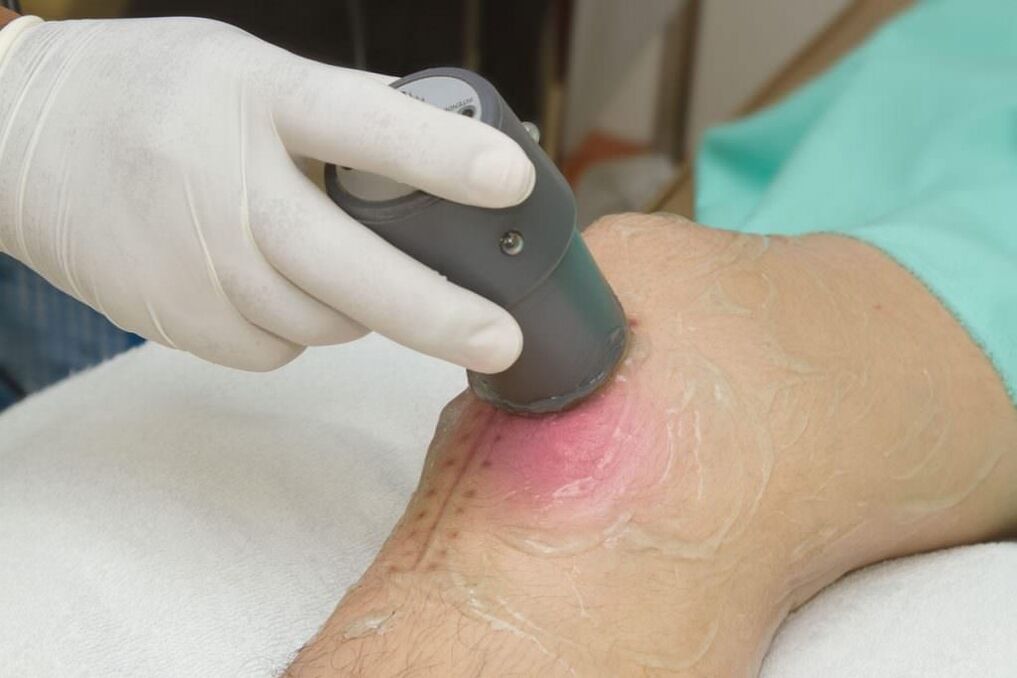 Ultrasound Introduction Procedure for Knee Arthritis