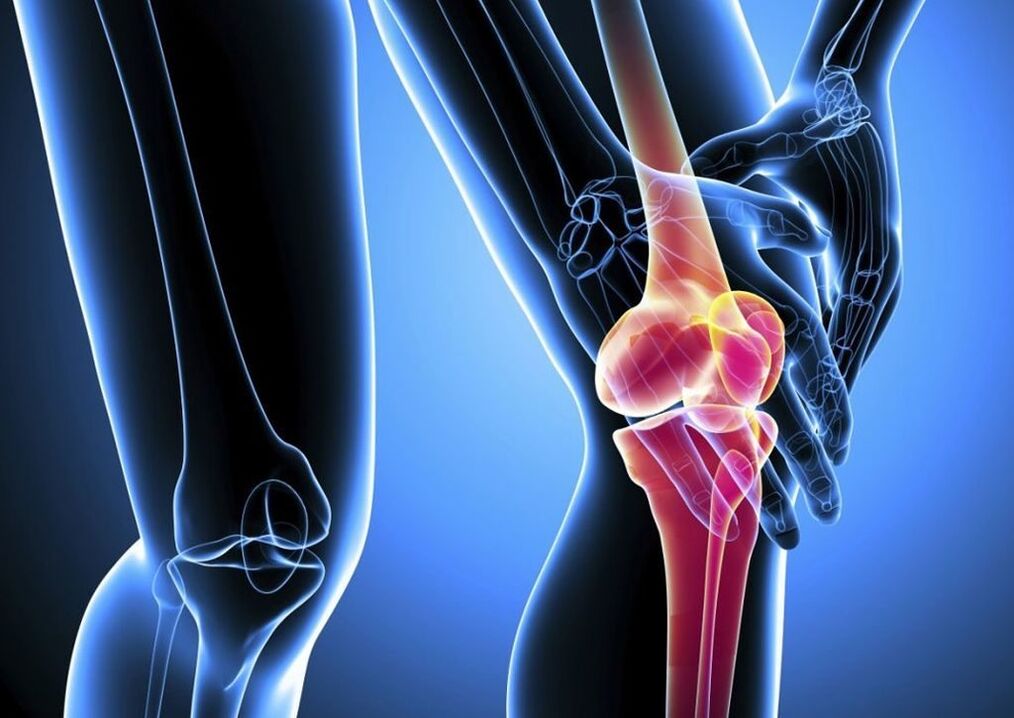 knee osteoarthritis pain during physical activity