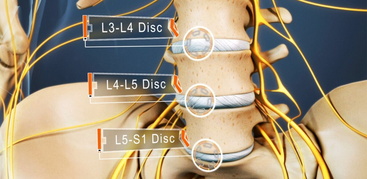 Lumbar disc, most commonly affected by osteochondrosis
