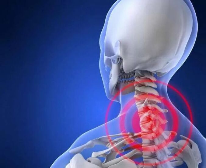 What is osteochondral disease