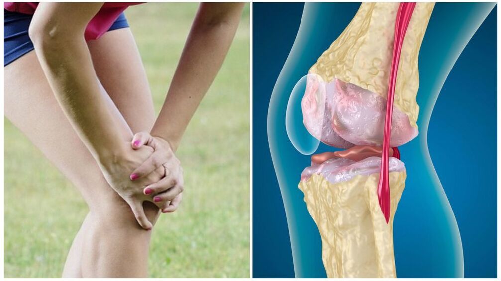 Joint symptoms