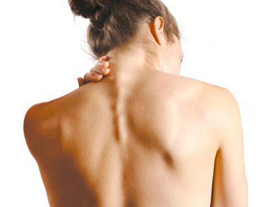 Girl suffering from cervical osteochondrosis