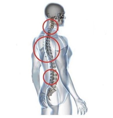 Site of spinal osteochondrosis