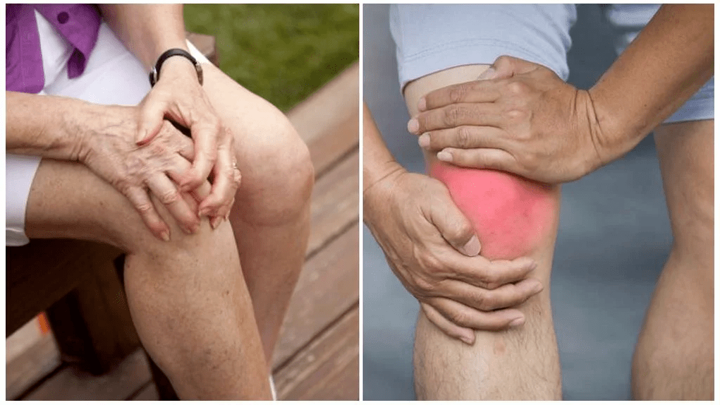 joint treatment