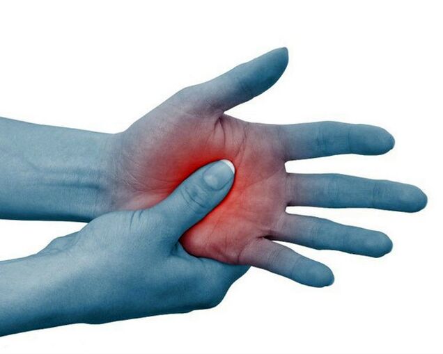 Severe pain in the finger joints is a classic symptom of rheumatoid arthritis and decreases with exercise.